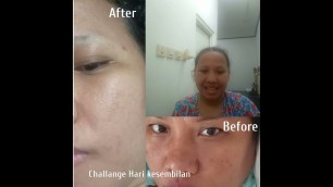 'Challenge Royal Jelly Lift Concentrate Serum hari ke9 (28Hari) - Jafra Cosmetic | Serum Royal Jelly'