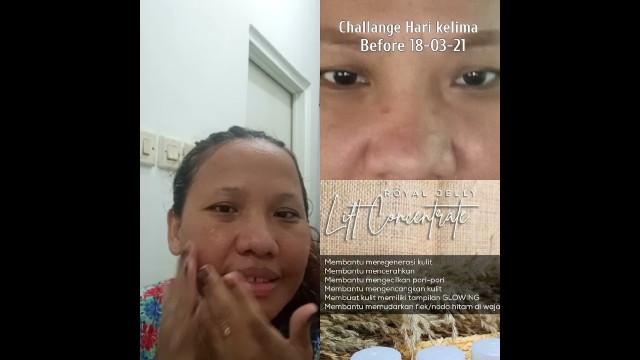 'Challenge Royal Jelly Lift Concentrate Serum hari ke5 (28 Hari)- Jafra Cosmetic | Serum Royal Jelly'